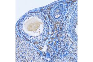 Immunohistochemistry of paraffin-embedded rat ovary using OGDH antibody. (alpha KGDHC antibody)
