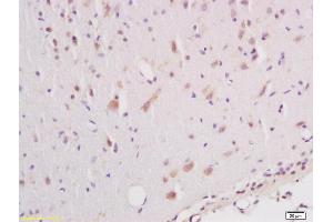 Formalin-fixed and paraffin embedded rat brain labeled with Anti phospho-B-Raf (Ser602) Polyclonal Antibody, Unconjugated (ABIN745373) at 1:200 followed by conjugation to the secondary antibody and DAB staining (SNRPE antibody  (pSer602))