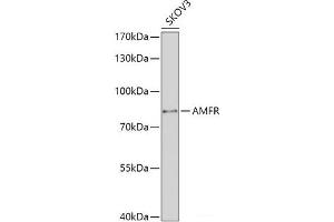 Western blot analysis of extracts of SKOV3 cells using AMFR Polyclonal Antibody at dilution of 1:1000. (AMFR antibody)