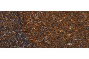 Immunohistochemistry of paraffin-embedded Human tonsil tissue using MIP Polyclonal Antibody at dilution 1:40 (Mip antibody)