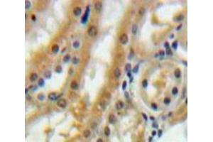 Used in DAB staining on fromalin fixed paraffin-embedded Kidney tissue