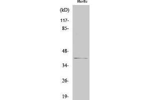 Western Blotting (WB) image for anti-Chloride Channel, Nucleotide-Sensitive, 1A (CLNS1A) (C-Term) antibody (ABIN3186440)