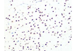 Immunohistochemistry of paraffin-embedded rat brain using DKC1 Rabbit mAb (ABIN7266869) at dilution of 1:100 (40x lens). (DKC1 antibody)