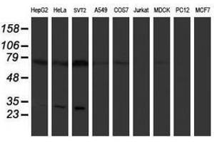 Image no. 1 for anti-Pallidin Homolog (PLDN) antibody (ABIN1500264) (Pallidin antibody)