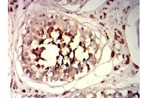 Immunohistochemical analysis of paraffin-embedded testis tissues using SP17 mouse mAb with DAB staining.