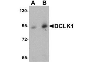 Western blot analysis of DCLK1 in human brain tissue lysate with AP30276PU-N DCLK1 antibody at (A) 0.