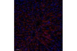 Immunofluorescence analysis of paraffin embedded human liver using CD35 (ABIN7073563) at dilution of 1: 650 (CD35 antibody)