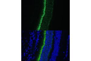 Immunofluorescence analysis of mouse eye using GNGT1 Polyclonal Antibody (ABIN7267288) at dilution of 1:100 (40x lens). (GNGT1 antibody  (AA 1-45))