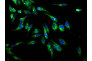 Immunofluorescence staining of Hela cells with ABIN7163704 at 1:66, counter-stained with DAPI. (PLXNB1 antibody  (AA 664-837))