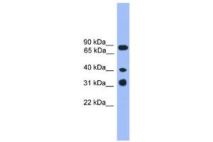 WB Suggested Anti-LAX1  Antibody Titration: 0. (LAX1 antibody  (C-Term))