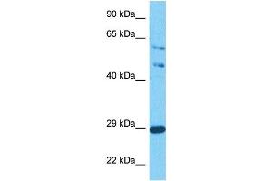 Host:  Rabbit  Target Name:  SPIC  Sample Tissue:  Human Jurkat Whole Cell  Antibody Dilution:  1ug/ml (SPIC antibody  (C-Term))