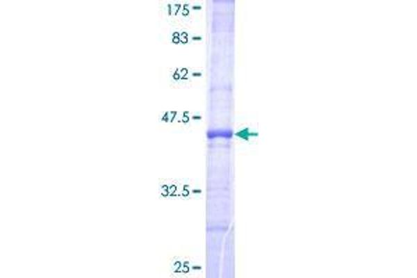 FBXL18 Protein (AA 1-110) (GST tag)