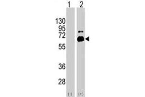Western blot analysis of RPS6KB1 (arrow) using RPS6KB1 polyclonal antibody . (RPS6KB1 antibody  (Ser424))
