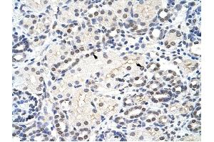 MRM1 antibody was used for immunohistochemistry at a concentration of 4-8 ug/ml to stain Epithelial cells of renal tubule (arrows) in Human Kidney.