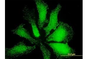 Immunofluorescence of monoclonal antibody to LMO3 on HeLa cell. (LMO3 antibody  (AA 91-146))