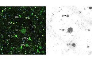 Immunohistochemical analysis of paraffin-embedded Alzheimer’s hippocampus using Thioflavin S (left panel) and ABIN1580412 using the HRP-DAB staining technique. (beta Amyloid antibody)