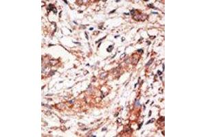 Image no. 1 for anti-Docking Protein 4 (DOK4) (C-Term) antibody (ABIN359961) (DOK4 antibody  (C-Term))