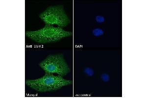 ABIN185361 Immunofluorescence analysis of paraformaldehyde fixed U2OS cells, permeabilized with 0. (Lipin 2 antibody  (C-Term))