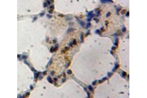 Used in DAB staining on fromalin fixed paraffin-embedded Lung tissue (Inhibitory Subunit of NF-KappaB zeta (AA 422-651) antibody)
