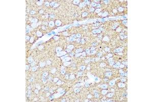Immunohistochemistry of paraffin-embedded mouse brain using NC / CD56 Rabbit pAb (ABIN1679098, ABIN3015129 and ABIN7101312) at dilution of 1:100 (40x lens). (CD56 antibody)