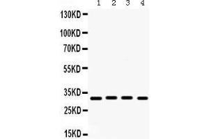Western Blotting (WB) image for anti-Kv Channel Interacting Protein 2 (KCNIP2) (AA 78-112), (N-Term) antibody (ABIN3043273) (KCNIP2 antibody  (N-Term))