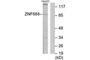 Western blot analysis of extracts from HepG2 cells, using ZNF785 Antibody. (ZNF785 antibody  (AA 91-140))