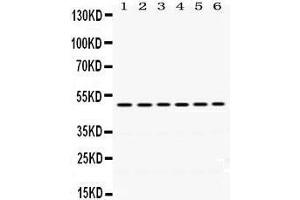 Western Blotting (WB) image for anti-Eukaryotic Translation Initiation Factor 4A2 (EIF4A2) (AA 5-31), (N-Term) antibody (ABIN3043426) (EIF4A2 antibody  (N-Term))