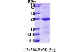 Image no. 1 for RAB10, Member RAS Oncogene Family (RAB10) protein (His tag) (ABIN1098775) (RAB10 Protein (His tag))