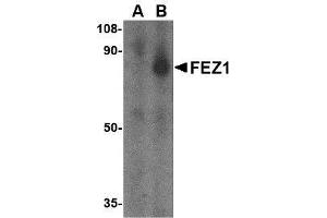 Western blot analysis of FEZ1 in SK-N-SH cell lysate with AP30333PU-N FEZ1 antibody at 1 μg/ml in the (A) presence and (B) absence of blocking peptide.