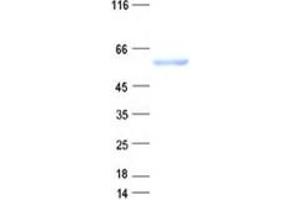 Validation with Western Blot (TBL1XR1 Protein (His tag))