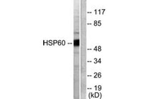Western blot analysis of extracts from COLO205 cells, using HSP60 Antibody. (HSPD1 antibody  (AA 511-560))