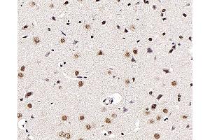 Immunohistochemistry analysis of paraffin-embedded rat brain using BRAF Polyclonal Antibody at dilution of 1:300. (BRAF antibody)