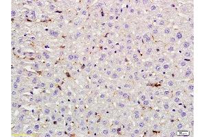 Formalin-fixed and paraffin embedded rat liver labeled with Rabbit Anti LIF Polyclonal Antibody, Unconjugated  at 1:200 followed by conjugation to the secondary antibody and DAB staining (LIF antibody  (AA 101-202))
