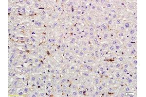 Formalin-fixed and paraffin embedded rat liver labeled with Rabbit Anti LIF Polyclonal Antibody, Unconjugated  at 1:200 followed by conjugation to the secondary antibody and DAB staining (LIF antibody  (AA 101-202))