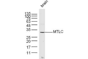Mouse brain lysates probed with MTLC Polyclonal Antibody, unconjugated  at 1:300 overnight at 4°C followed by a conjugated secondary antibody at 1:10000 for 60 minutes at 37°C. (Myc Target 1 antibody  (AA 21-100))