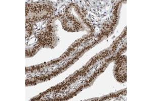 Immunohistochemical staining of human esophagus with YTHDC1 polyclonal antibody  shows strong cytoplasmic and nuclear positivity in squamous epithelial cells at 1:200-1:500 dilution.