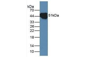 Detection of CK14 in Rat Skin Tissue using Polyclonal Antibody to Cytokeratin 14 (CK14) (KRT14 antibody  (AA 111-418))