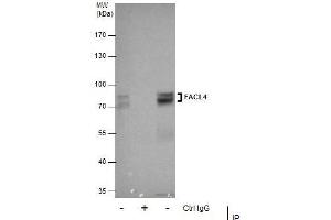 IP Image Immunoprecipitation of FACL4 protein from HeLa whole cell extracts using 5 μg of FACL4 antibody [C3], C-term, Western blot analysis was performed using FACL4 antibody [C3], C-term, EasyBlot anti-Rabbit IgG  was used as a secondary reagent. (ACSL4 antibody  (C-Term))