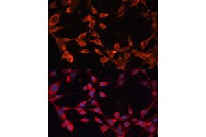 Immunofluorescence analysis of NIH/3T3 cells using SLC25 antibody (ABIN6132701, ABIN6147913, ABIN6147915 and ABIN6215984) at dilution of 1:100. (SLC25A19 antibody  (AA 1-80))