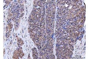 IHC analysis of BAT3/BAG6 using anti-BAT3/BAG6 antibody (ABIN6719601).