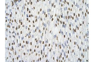 Immunohistochemistry (IHC) image for anti-Heterogeneous Nuclear Ribonucleoprotein A1 (HNRNPA1) (N-Term) antibody (ABIN2778789)