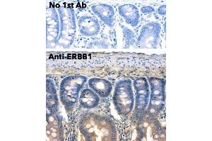 Immunohistochemistry (IHC) image for anti-Epidermal Growth Factor Receptor (EGFR) (C-Term) antibody (ABIN6254171)