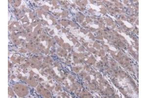 Detection of RARb in Human Stomach Tissue using Polyclonal Antibody to Retinoic Acid Receptor Beta (RARb) (Retinoic Acid Receptor beta antibody  (AA 205-451))