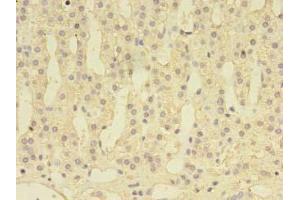 Immunohistochemistry of paraffin-embedded human adrenal gland tissue using ABIN7149667 at dilution of 1:100 (DENND1A antibody  (AA 1-559))