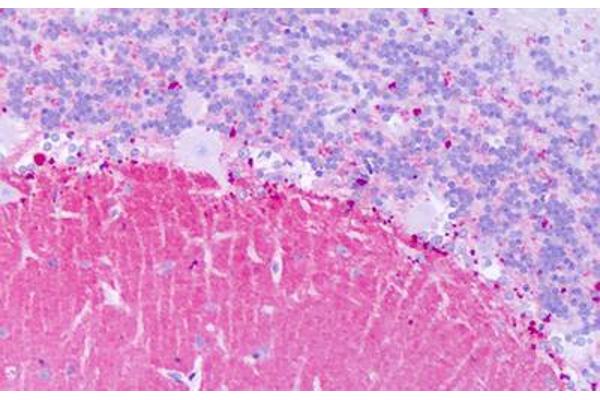 KISS1R antibody  (Extracellular Domain)