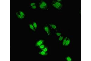 Immunofluorescent analysis of HepG2 cells using ABIN7149283 at dilution of 1:100 and Alexa Fluor 488-congugated AffiniPure Goat Anti-Rabbit IgG(H+L) (CYGB antibody  (AA 1-190))
