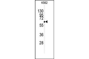 Image no. 1 for anti-Ubiquitin Specific Peptidase 3 (USP3) (C-Term) antibody (ABIN357524) (USP3 antibody  (C-Term))