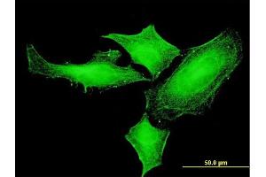 Immunofluorescence of monoclonal antibody to PIM1 on HeLa cell. (PIM1 antibody  (AA 1-313))