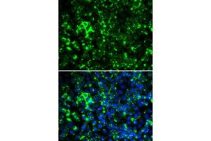 Immunofluorescence analysis of HeLa cells using KCN antibody (ABIN6129438, ABIN6142695, ABIN6142696 and ABIN6221897). (KCNA2 antibody  (AA 1-165))