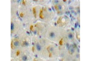 IHC-P analysis of Liver tissue, with DAB staining. (TNFRSF11A antibody  (AA 359-542))